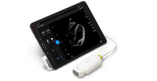 Lumify ultrasound probe
